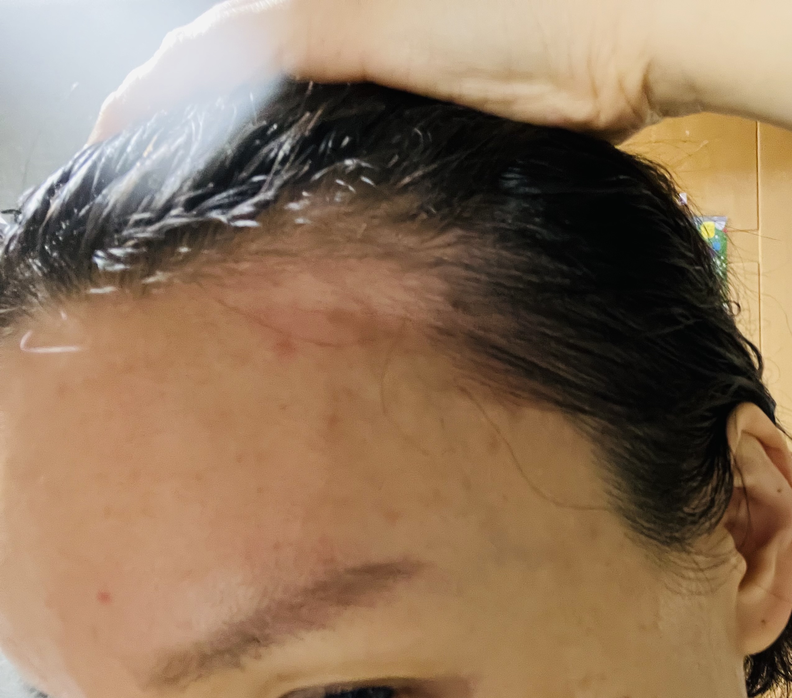 탈모아지매;;ㅋㅋ(뽀샵없어서 눈배림주의)