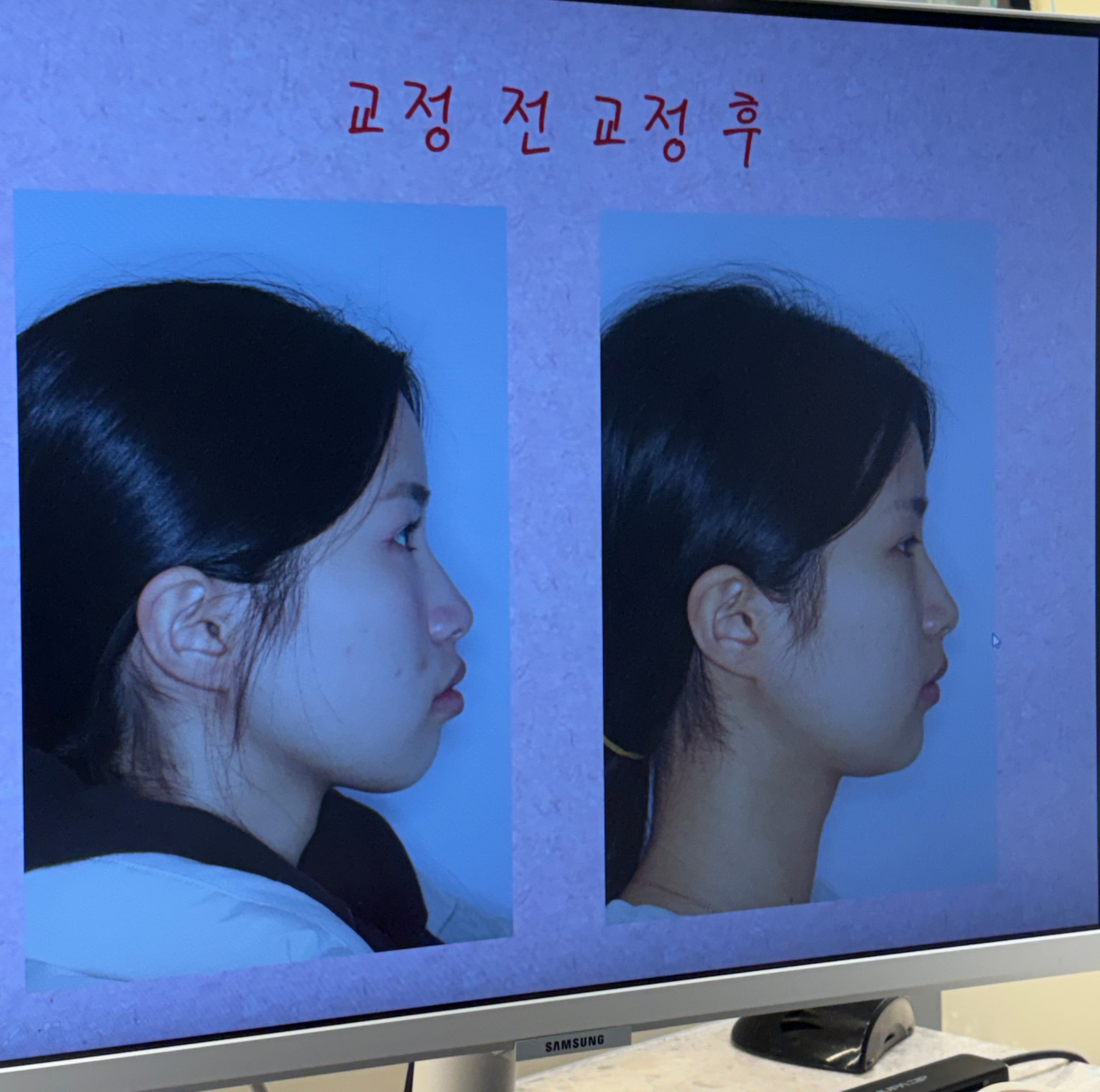 이전글