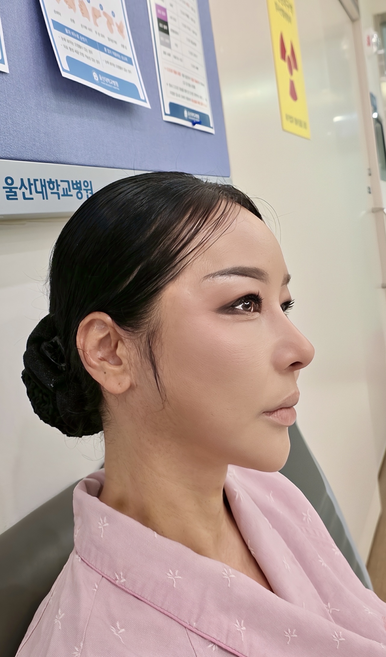 갤러리 이미지